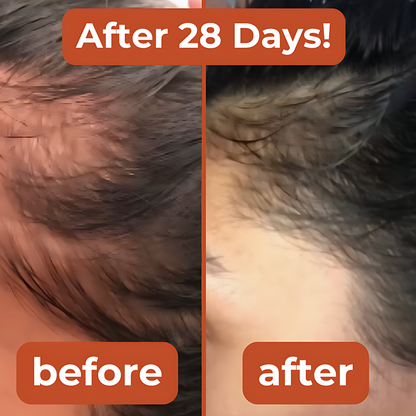 Thryv Pumpkin Seed Oil Softgels.