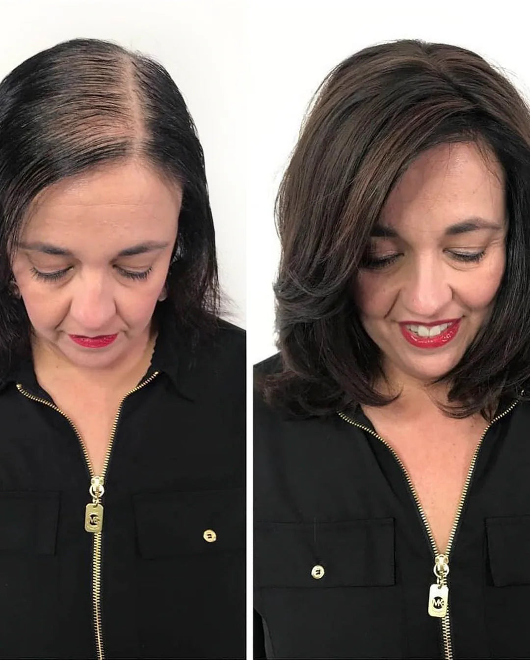 New hair growth within 2 weeks