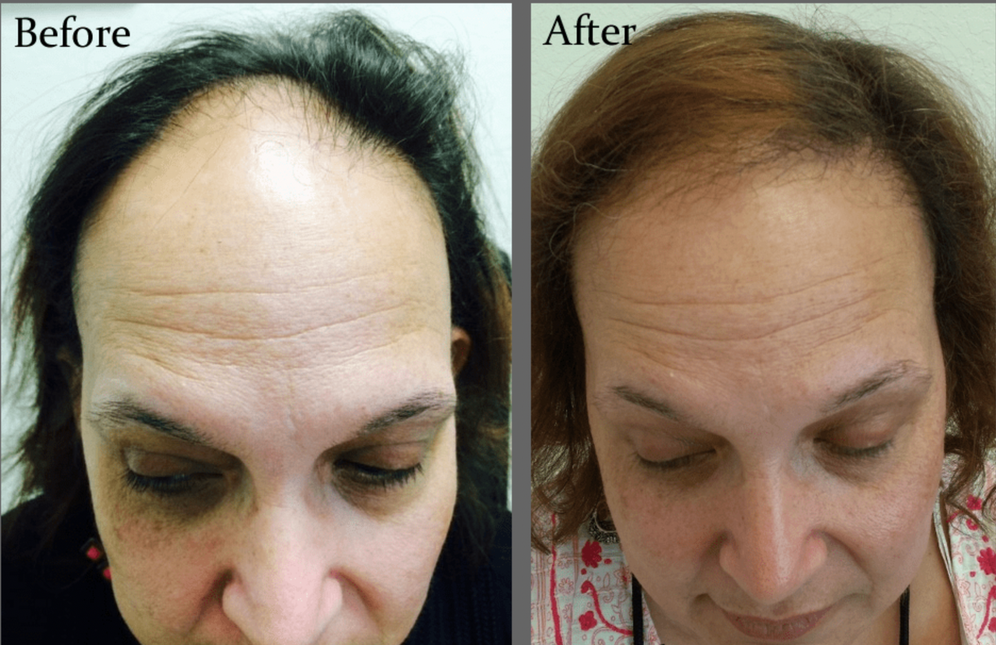 New hair growth within 2 weeks