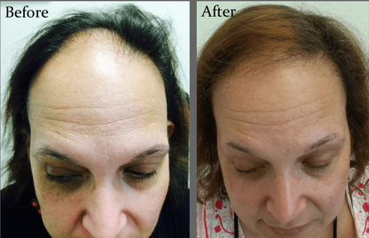 New hair growth within 2 weeks